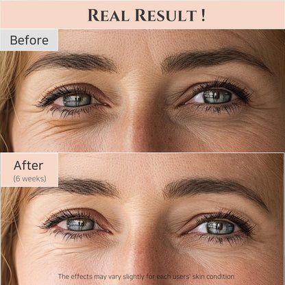 Beauty of Joseon Revive Eye Serum: Ginseng + Retinal – 30ml / 1 fl oz